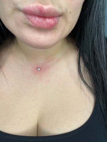 Dermal — Black Ink Art