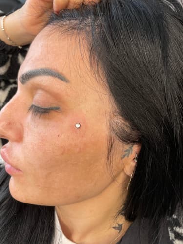 Dermal — Black Ink Art