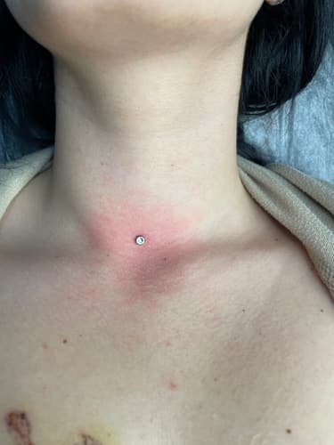 Dermal — Black Ink Art
