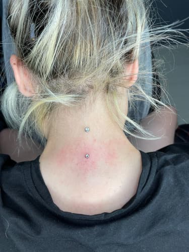 Dermal — Black Ink Art