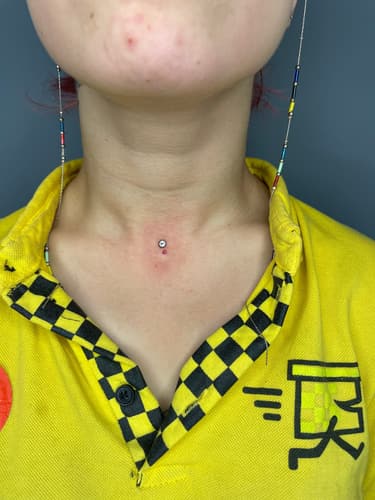 Dermal — Black Ink Art