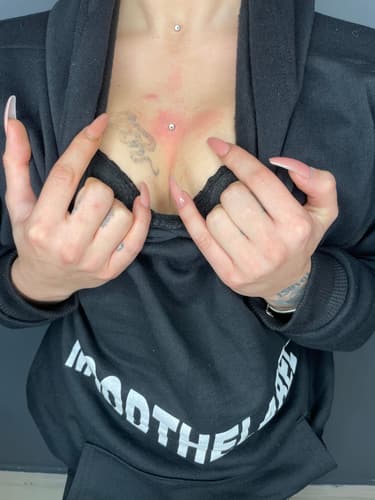 Dermal — Black Ink Art