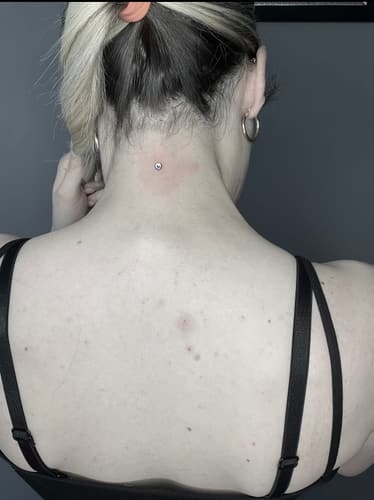 Dermal — Black Ink Art