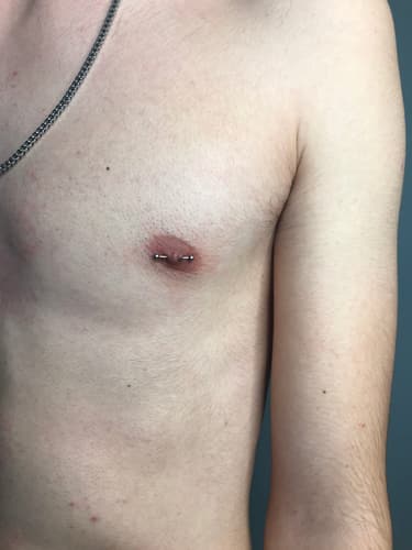 Nipple — Black Ink Art