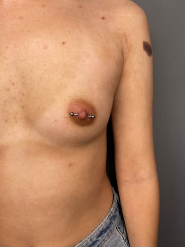 Nipple — Black Ink Art
