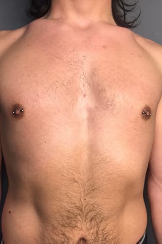 Nipple — Black Ink Art