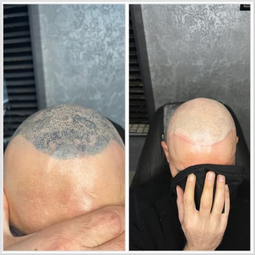 Cover-up & Scar-up — Black Ink Art