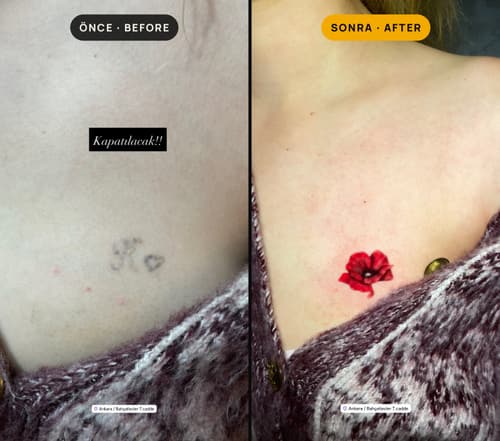 Cover-up & Scar-up — Black Ink Art