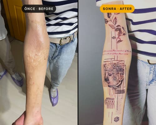 Cover-up & Scar-up — Black Ink Art