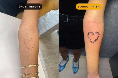 Cover-up & Scar-up — Black Ink Art