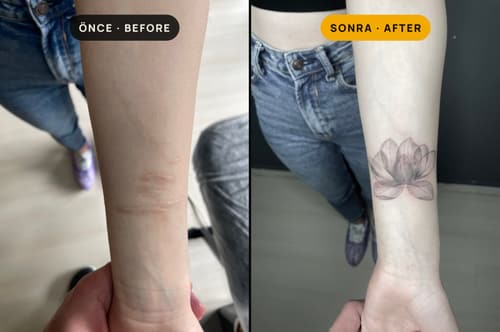 Cover-up & Scar-up — Black Ink Art