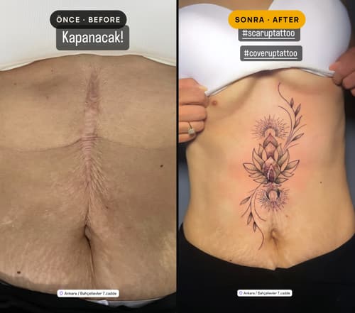 Cover-up & Scar-up — Black Ink Art