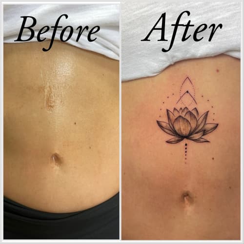 Cover-up & Scar-up — Black Ink Art